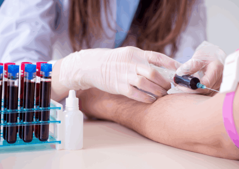 Histaminintoleranz erkennen – Tests für Zuhause