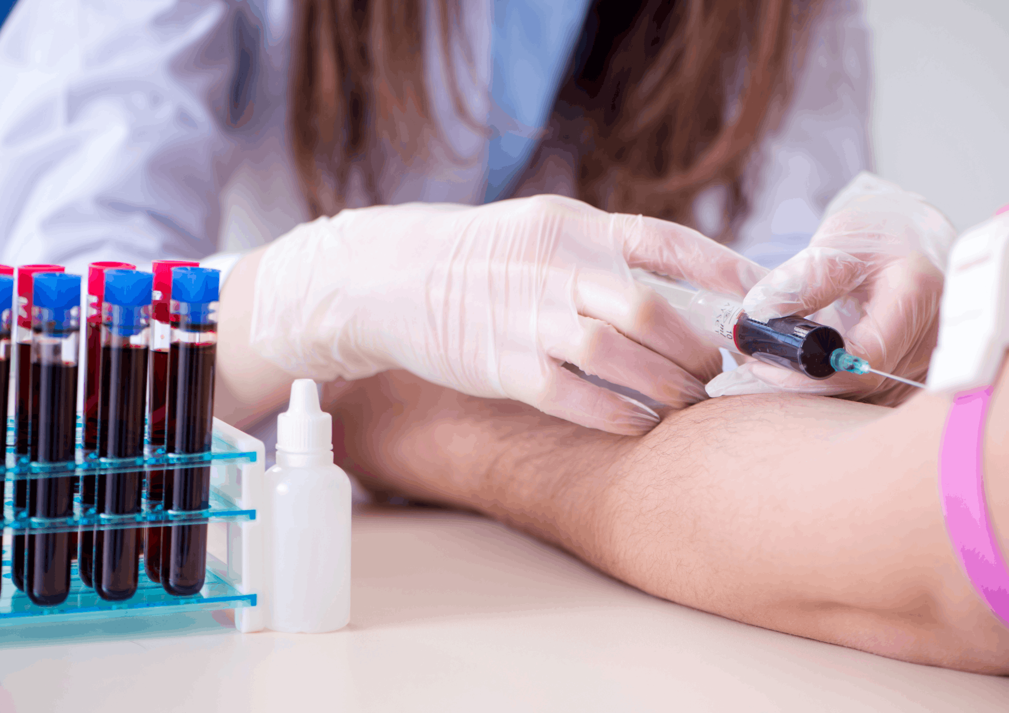 Histaminintoleranz erkennen – Tests für Zuhause
